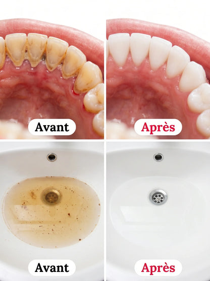 Bain de bouche détachant Boundary - Nettoyage en profondeur, saveur menthe longue durée